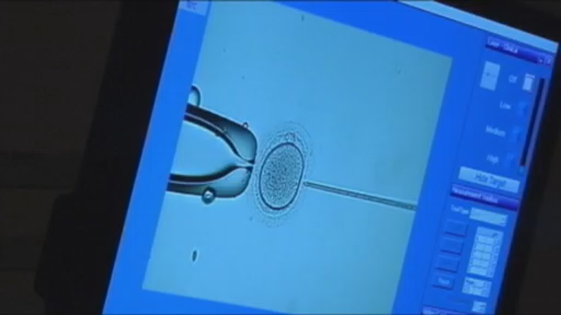 IVF